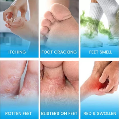 Foot Antibacterial Cream, Athlete's Foot Odor Foot Cream